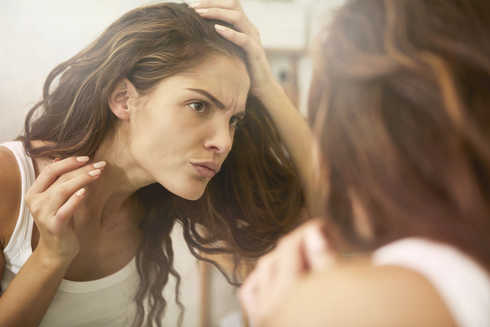 psoriasis