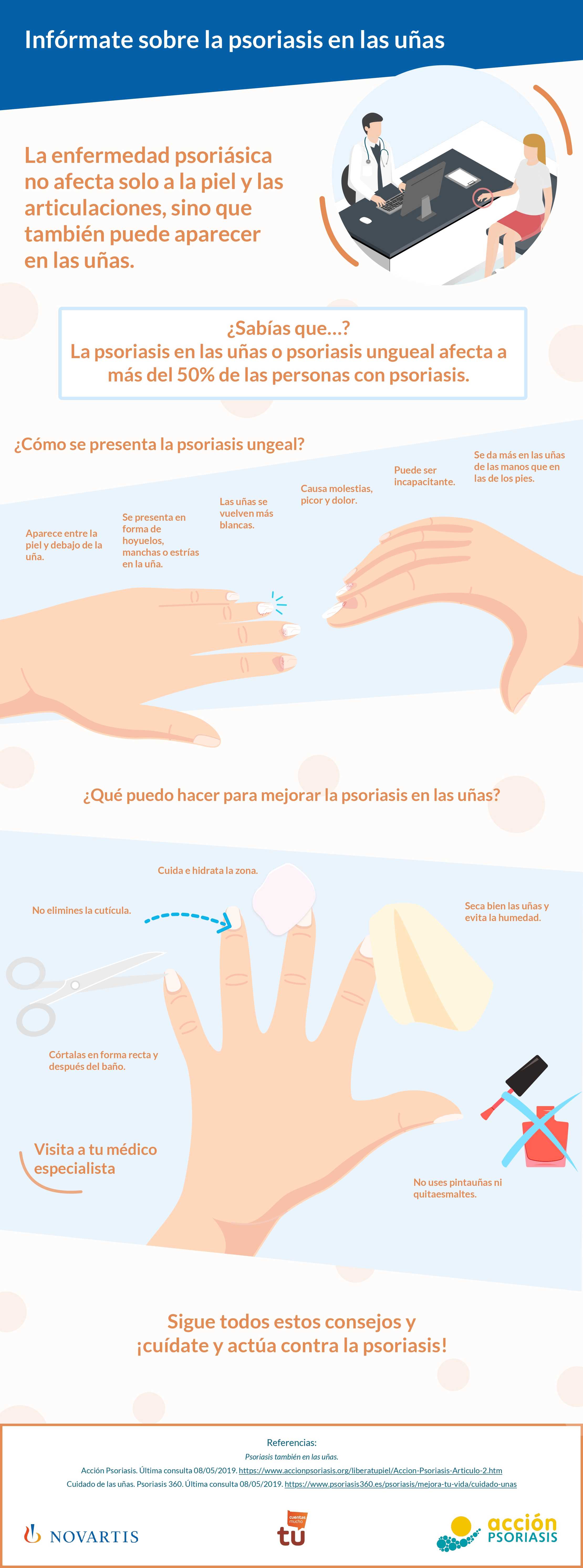 Psoriasis en las uñas: todo lo que debes saber