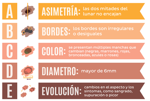 melanoma