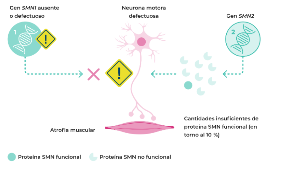 ¿Qué es la Atrofia Muscular Espinal (AME)?