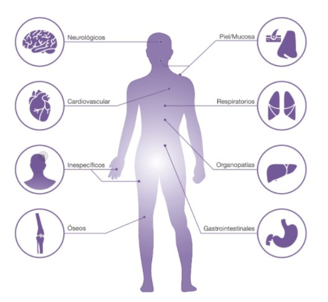 Mastocitosis Sistémica
